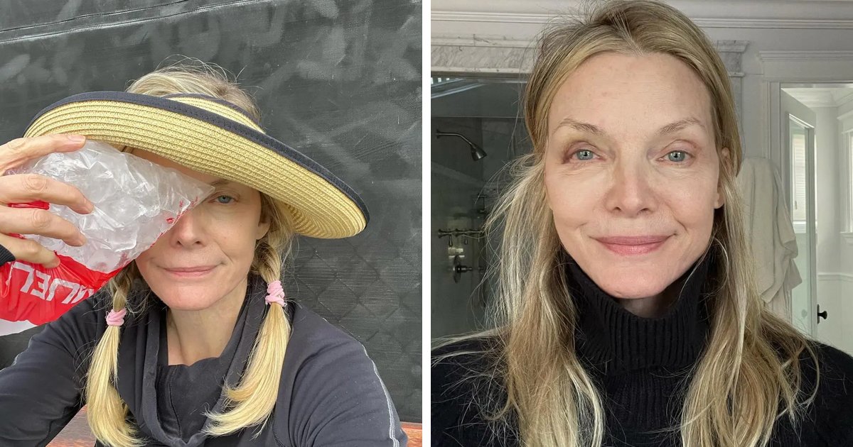 d159 1.jpg?resize=412,275 - BREAKING: Fans Devastated As Actress Michelle Pfeiffer Smiles Through The Pain After Showing Off Fresh BLACK EYE