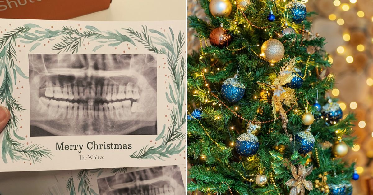 teeth6.jpg?resize=412,232 - Man Accidentally Prints Dental X-Ray On His Family Christmas Cards And It's Not Even His But Belongs To His Neighbor