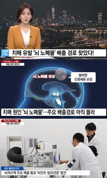1 39.jpg?resize=412,232 - 치매 연구 근황 ㄷㄷ