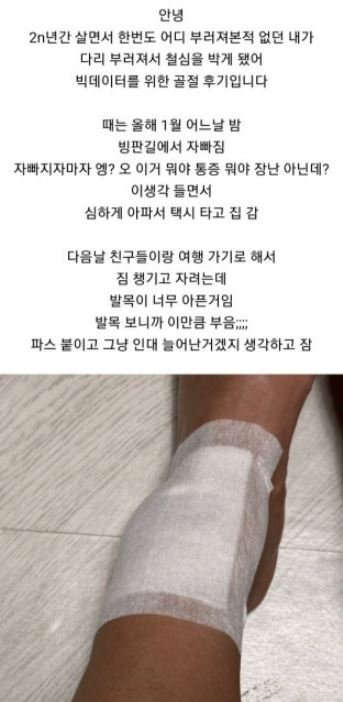 7 1.jpg?resize=1200,630 - 발목 부러졌는데 하나도 안 아프다는 여자의 11개월 뒤 근황 ㄷㄷㄷ