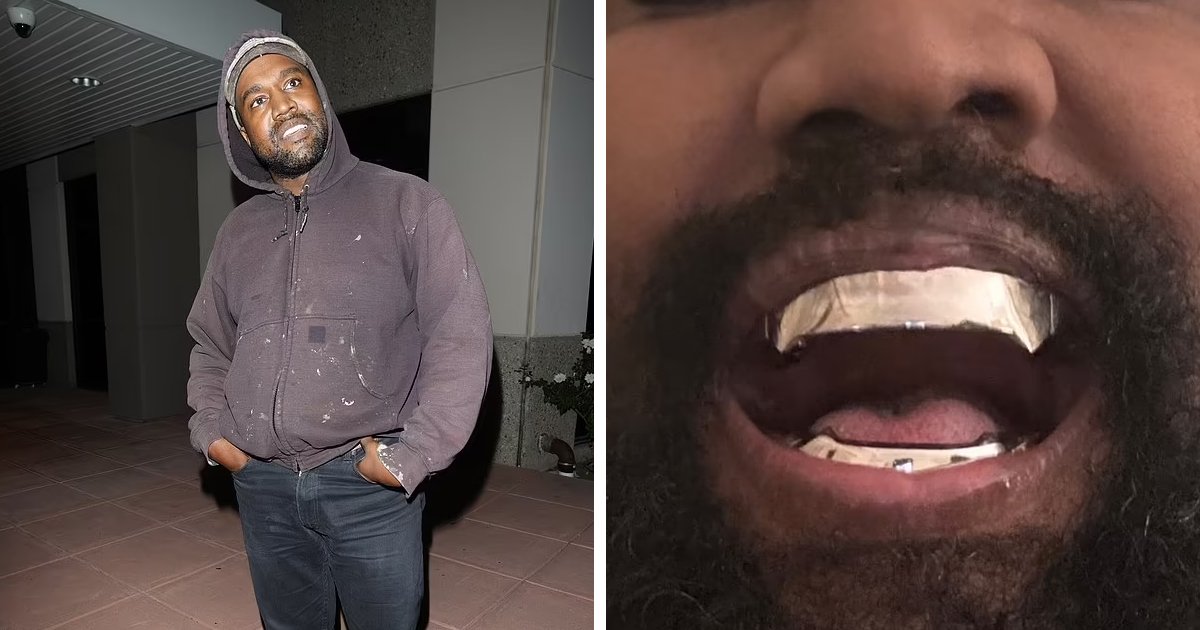m3 8 1.jpg?resize=1200,630 - "Somebody Help That Man, He's NOT Normal!"- Kanye West Shocks Fans After REMOVING All His Teeth For $850k Titanium Dentures