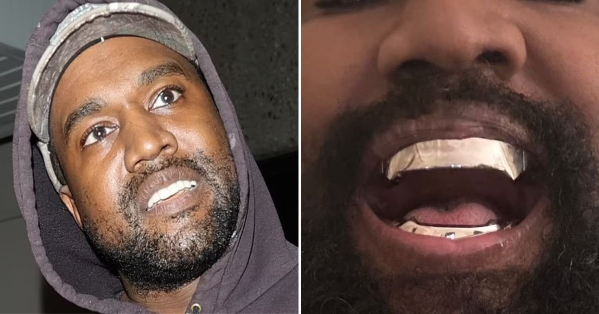 untitled design 88.jpg?resize=1200,630 - Kanye West Brutally Mocked After Replacing His Teeth With 'Revolting' Titanium Dentures