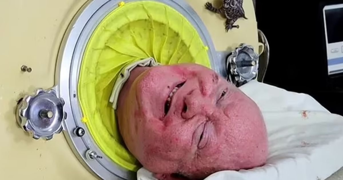 copy of articles thumbnail 1200 x 630 6 3.jpg?resize=412,275 - Man Who Spent 70 YEARS Living Inside ‘Iron Lung’ Found DEAD Aged 78
