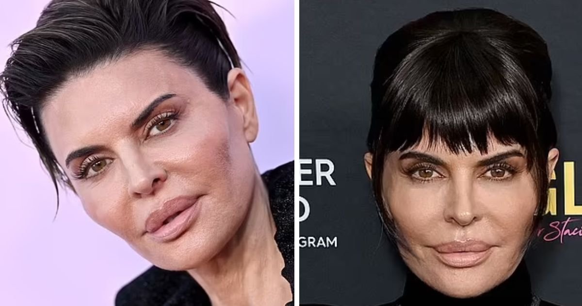 copy of articles thumbnail 1200 x 630 5 14.jpg?resize=412,275 - "Her Face, What Happened!"- Lisa Renna Debuts New UNRECOGNIZABLE Look That Has Fans WORRIED