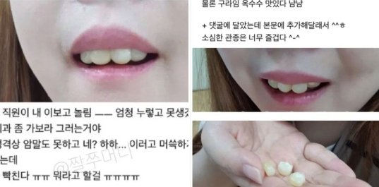 20240602131947.png?resize=412,275 - 앞니가 너무 못생긴 여자