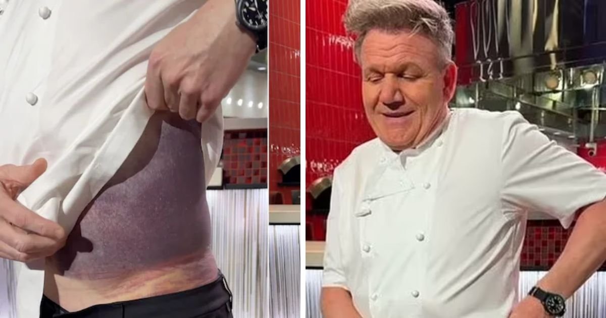 copy of articles thumbnail 1200 x 630 6 9.jpg?resize=1200,630 - Chef Gordon Ramsey Suffers Horrific Injuries In 'Near Death' Cycling Accident