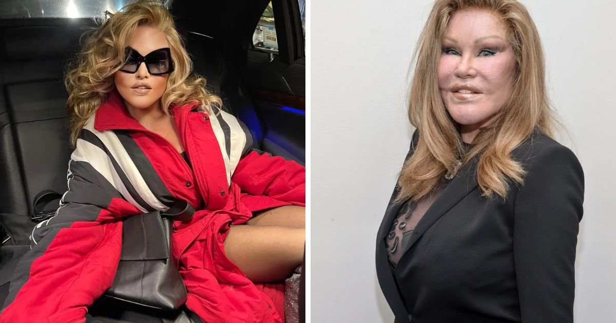 copy of articles thumbnail 1200 x 630 16 2.jpg?resize=1200,630 - ‘Catwoman’ Jocelyn Wildenstein Reveals Her ‘Original Face’ Leaving Fans STUNNED