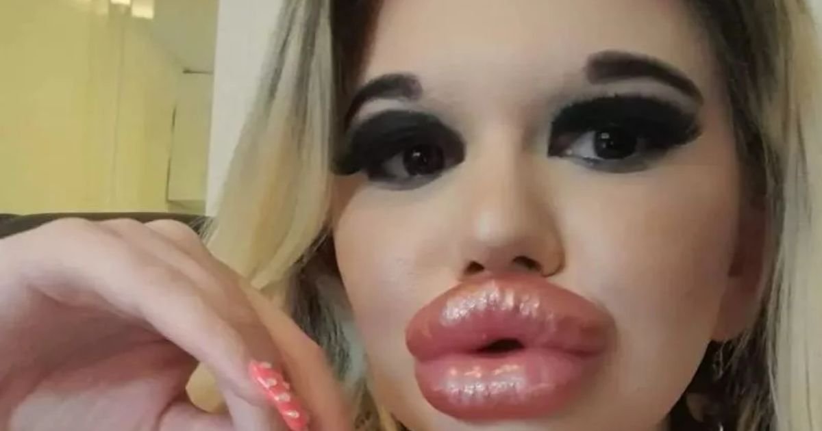 copy of articles thumbnail 1200 x 630 10 16.jpg?resize=1200,630 - Woman With World’s Biggest Lips Says Finding A Man Has Become IMPOSSIBLE For Her