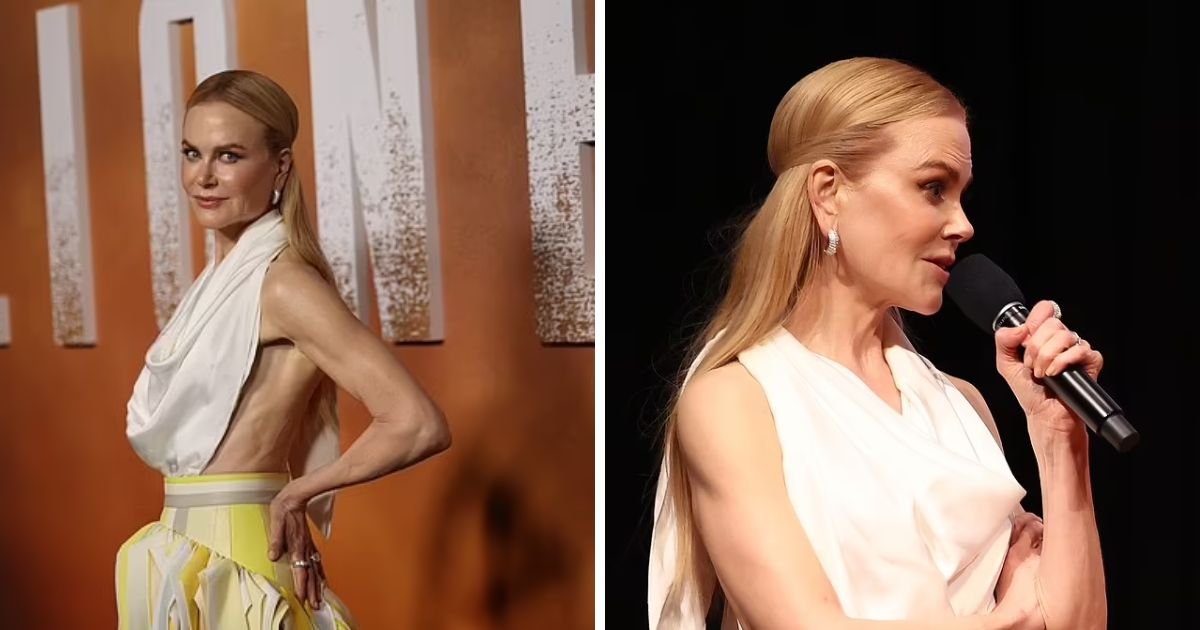 copy of articles thumbnail 1200 x 630 11 13.jpg?resize=1200,630 - "Please Eat!"- Fans Express Concerns For Nicole Kidman After Star Looks 'Thinner Than Ever' As She's Seen Tearing Up On Red Carpet