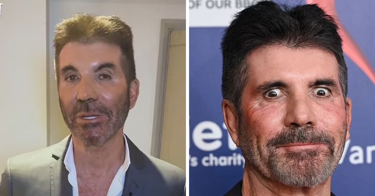 copy of articles thumbnail 1200 x 630 2 14.jpg?resize=1200,630 - What's Wrong With His Face? Fans React As Simon Cowell's Ever Changing Face Leaves Many Stunned