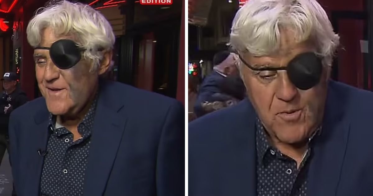 copy of articles thumbnail 1200 x 630 2 18.jpg?resize=1200,630 - Fans Concerned For Jay Leno After Star Sports Heavily BRUISED Face With Eye Patch