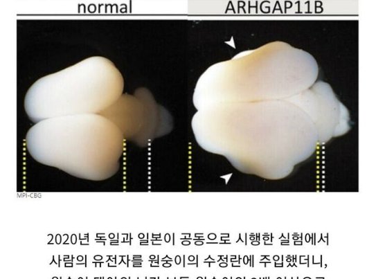 10 29.png?resize=412,232 - 사람 유전자를 원숭이 수정란에 주입한 결과.
