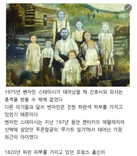 5 22.png?resize=412,232 - 200년간 가문의 피부가 파란색 이였던 이유