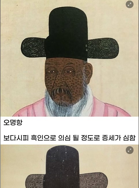 6 9.png?resize=1200,630 - 싱글벙글 조선시대 초상화에 나온 질병들