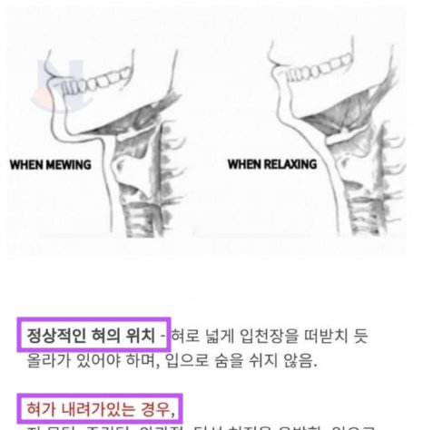 7 20.png?resize=1200,630 - 혀 위치만 바꿔도 잘생겨질수밖에 없는 뮤잉 운동..