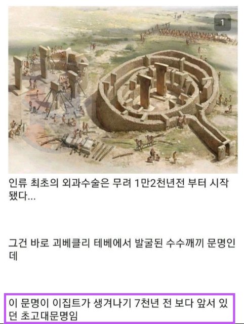 8 36.png?resize=1200,630 - 믿을 수가 없는 '1만 2천년전 뇌수술'