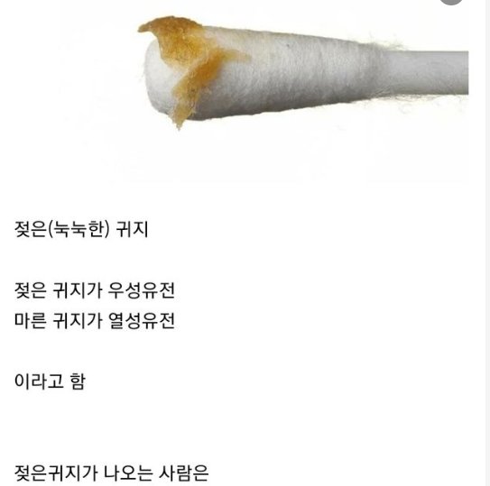 9 32.png?resize=412,232 - 한국사람은 드물다는 귀지 타입