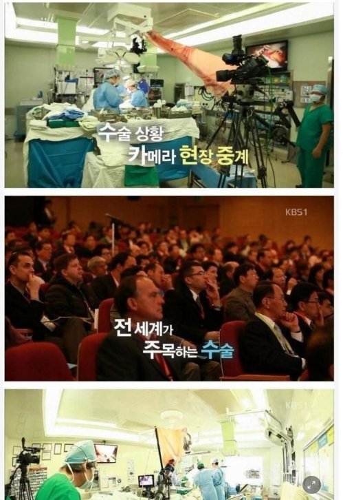 9 4.png?resize=412,232 - 세계 최고의 간이식 수술 전문가의 위엄.