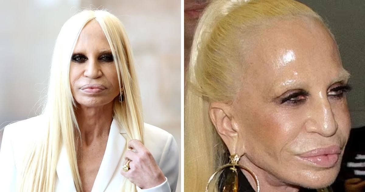 copy of articles thumbnail 1200 x 630 5 7.jpg?resize=1200,630 - What Has Donatella Versace Done To Her Face Now? Fans STUNNED At Her Wild Transformation