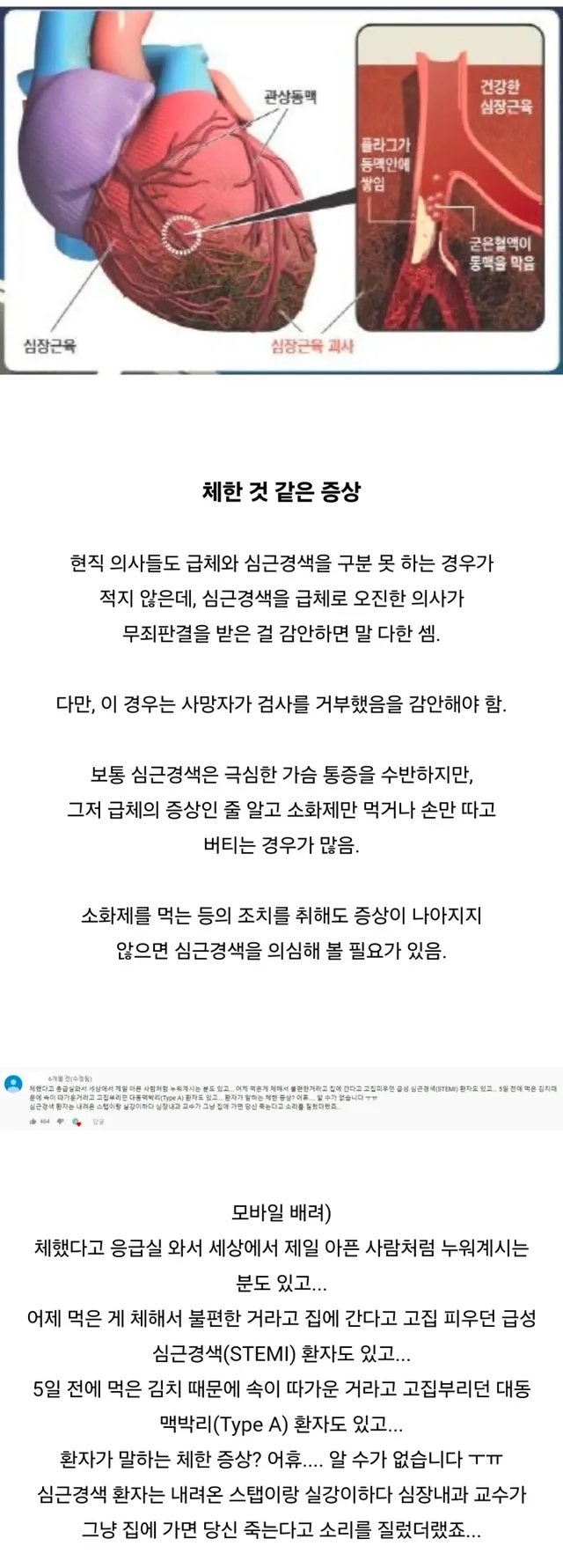 심근경색의 대표적인 전조증상 jpg