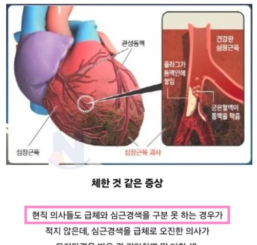 6 44.png?resize=412,275 - 경력직의사도 오진한다는 심근경색의 대표적인 전조증상...