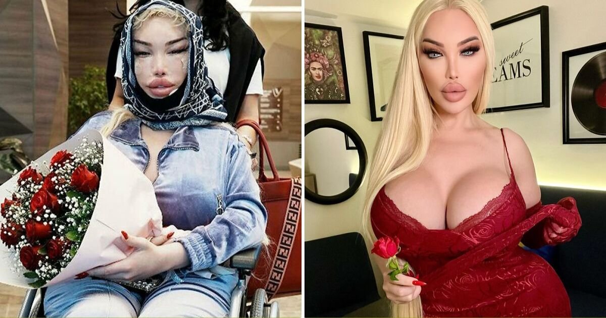 copy of articles thumbnail 1200 x 630 6 17.jpg?resize=412,232 - Television Star Shows Off Her Incredible $1 MILLION Plastic Surgery Transformation