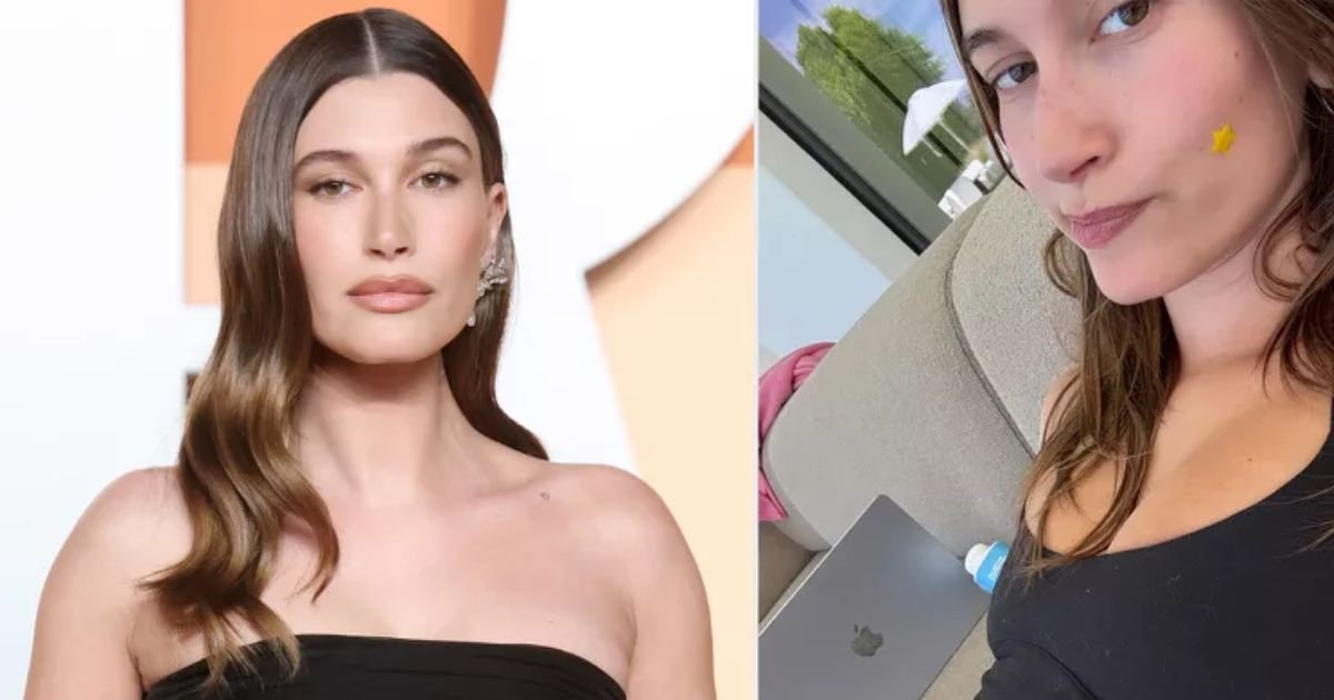copy of articles thumbnail 1200 x 630 30 4.jpg?resize=412,275 - Supermodel Hailey Bieber Shares Heartbreaking Medical Diagnosis with Fans