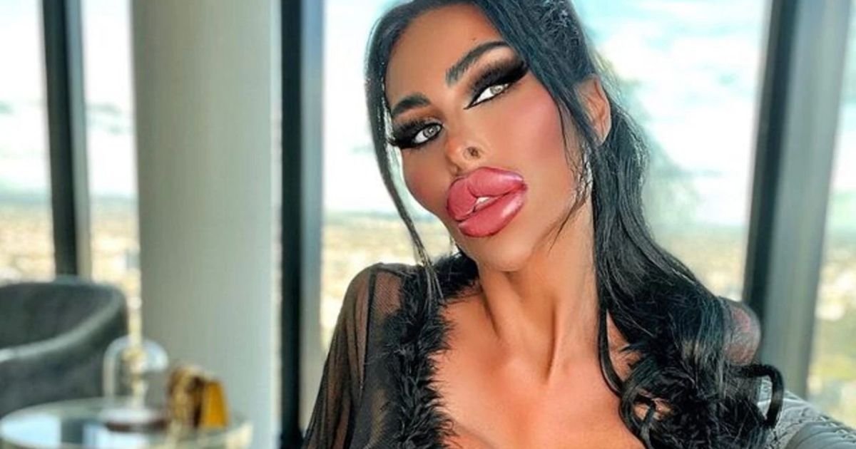 copy of articles thumbnail 1200 x 630 57.jpg?resize=412,232 - Human Barbie Spends $200K on Plastic Surgery Because She Hated the Way She Looked