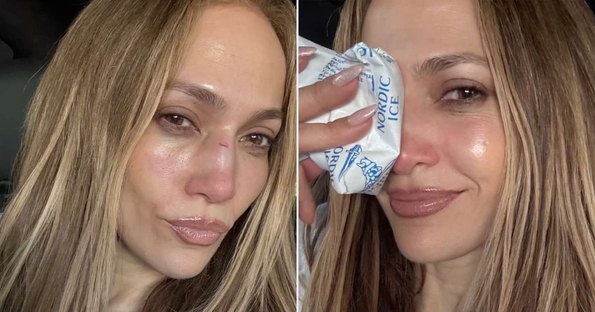 copy of articles thumbnail 1200 x 630 21 5.jpg?resize=412,232 - Jennifer Lopez Suffers Brutal Injuries During Rehearsals of the American Music Awards 2025