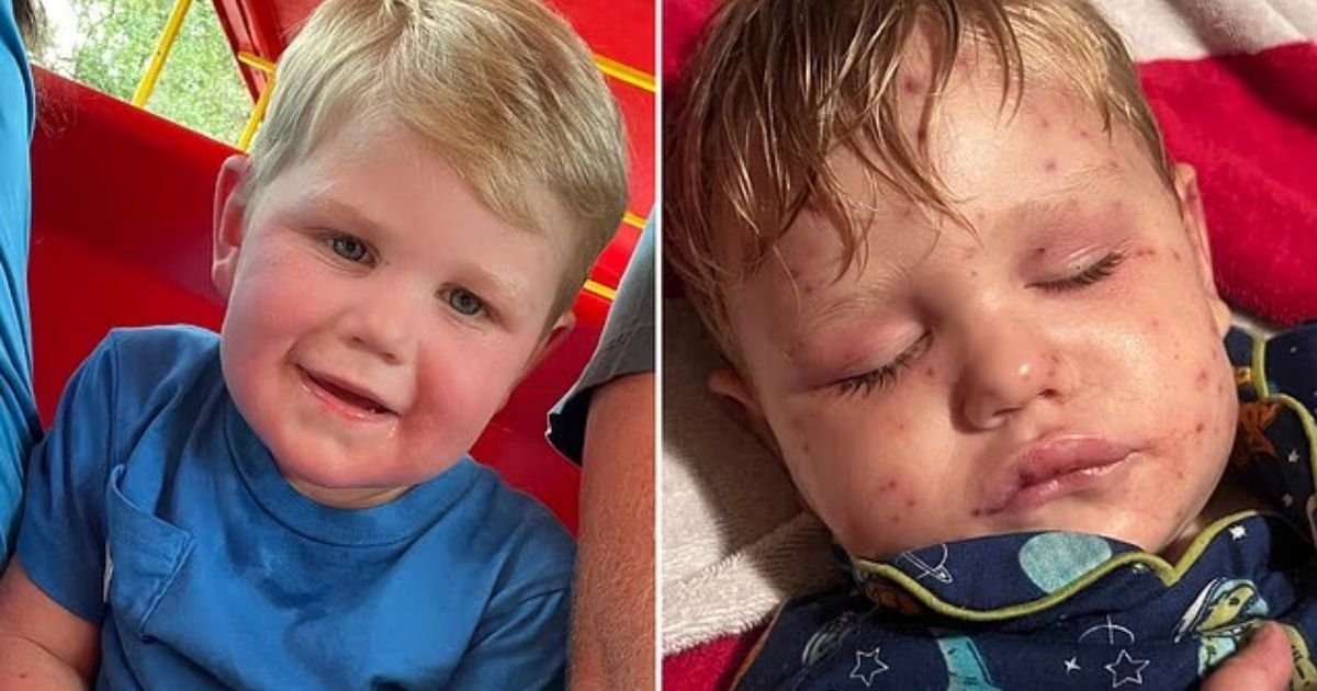 copy of articles thumbnail 1200 x 630 95 6.jpg?resize=1200,630 - Georgia Toddler With Missing Kidney Left On Life Support After Being Stung Over 150 Times by Wasps
