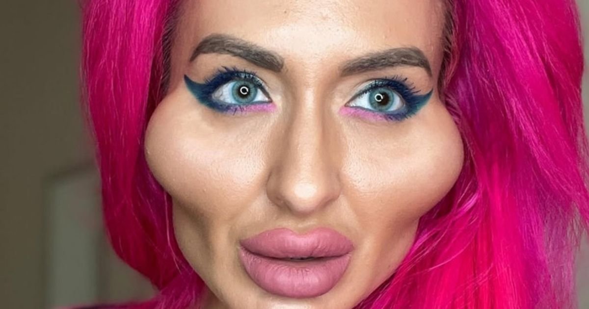 copy of articles thumbnail 1200 x 630 2025 07 29t140558 507.jpg?resize=412,232 - Woman with 'world's biggest cheeks' hits back at trolls who mock her looks