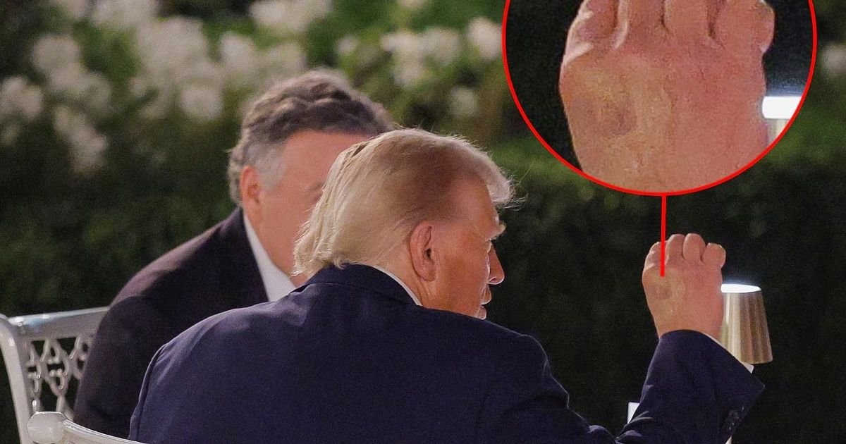 copy of articles thumbnail 1200 x 630 2025 09 06t222536 284.jpg?resize=412,232 - Trump’s Makeup-Slathered Hand Pops Up at Rose Garden Dinner As President Tries His Best to Hide Hands Under the Table